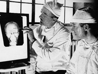 Surgeons looking at X-ray of skull of lobotomy patient 