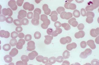 red blood cells