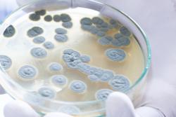 petri dish with mold